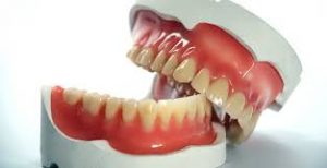 proteze dentare mobile